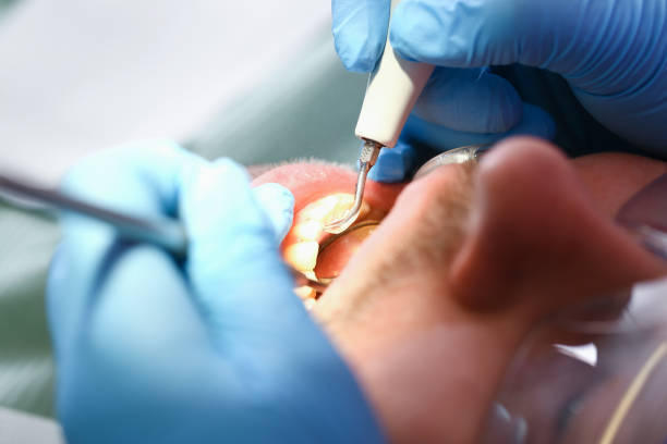 Best Emergency Dental Care for Broken or Chipped Teeth in Shawnee, OK