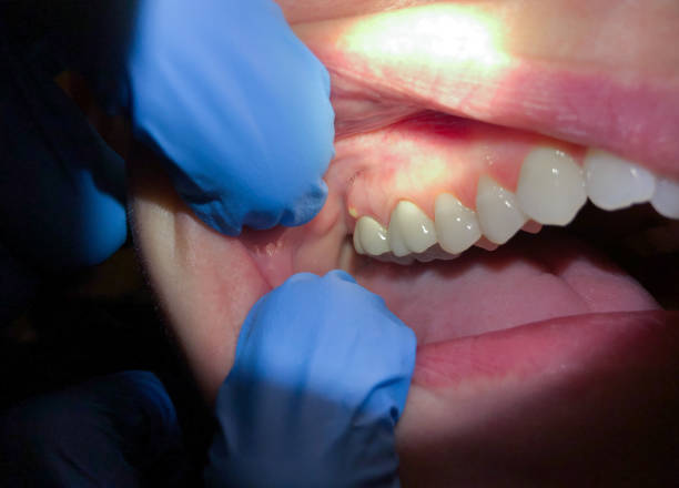 Best Emergency Root Canal Treatment in Shawnee, OK
