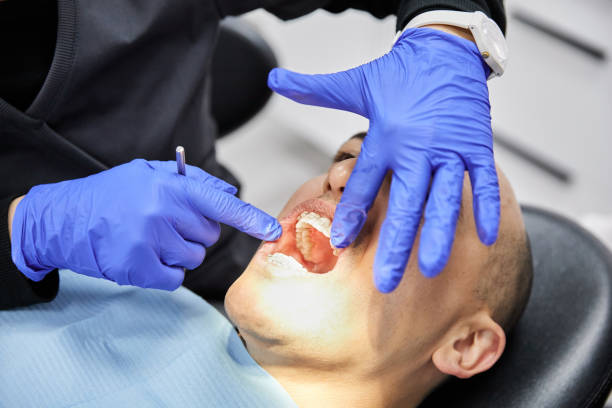 Best Emergency Treatment for Dental Infections or Abscesses in Shawnee, OK