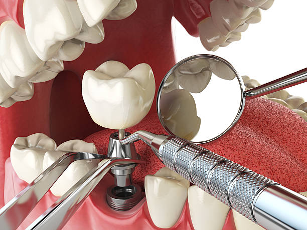 Best Emergency Gum Treatment in Shawnee, OK